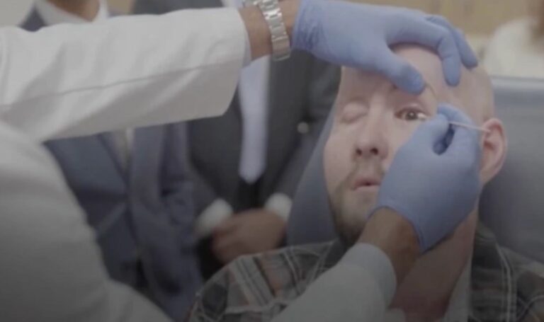 Dünyanın ilk tam göz nakli hastası 'olağanüstü' ilerleme kaydetti – Son Dakika Dünya Haberleri